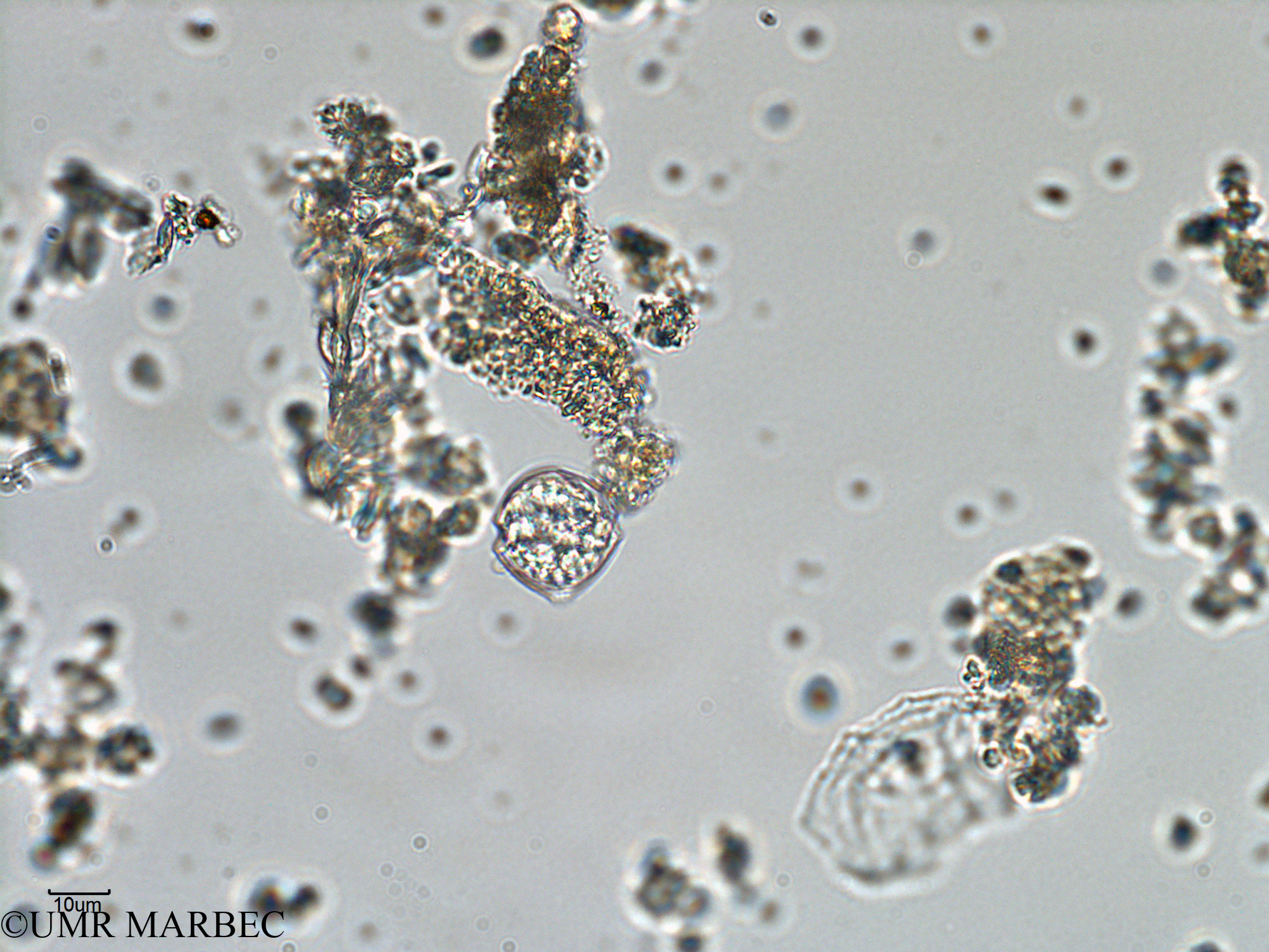 phyto/Bizerte/bizerte_bay/RISCO February 2015/Scrippsiella trochoidea (old Scrippsiella spp -ancien Baie_T1-A_Dino6-2).tif(copy).jpg